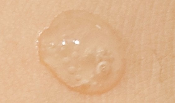 fractionalCC ニードルセラムC/fractionalCC/美容液を使ったクチコミ(3枚目)