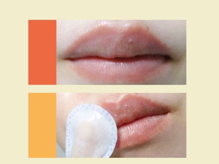 リップエイド集中マスク/トレンドホリック/リップマスクを使ったクチコミ(8枚目)