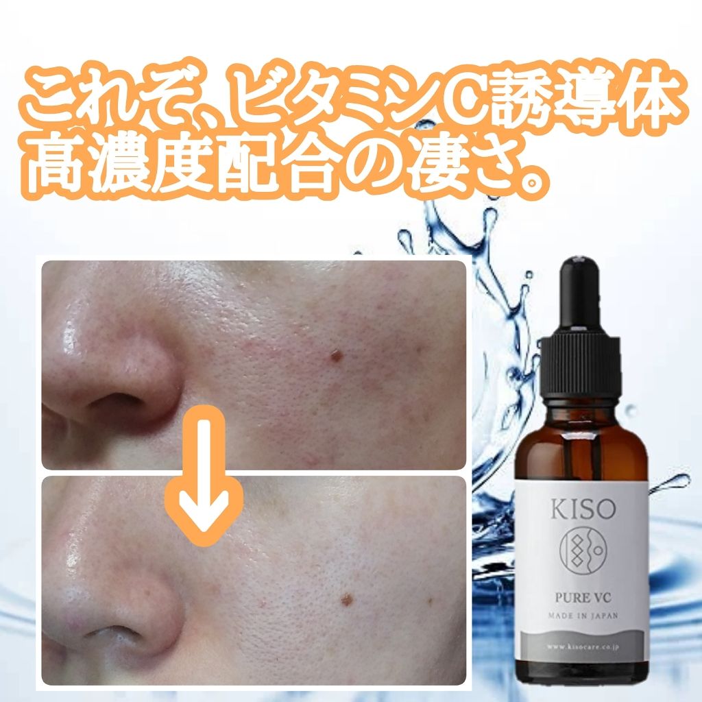 ハトムギ化粧水(ナチュリエ スキンコンディショナー R )/ナチュリエ/化粧水を使ったクチコミ(1枚目)