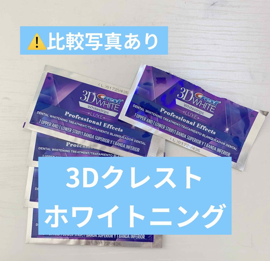 クレスト3Dホワイトニング ホワイトストリップ プロフェッショナル エフェクツ/クレスト/その他オーラルケアを使ったクチコミ（1枚目）