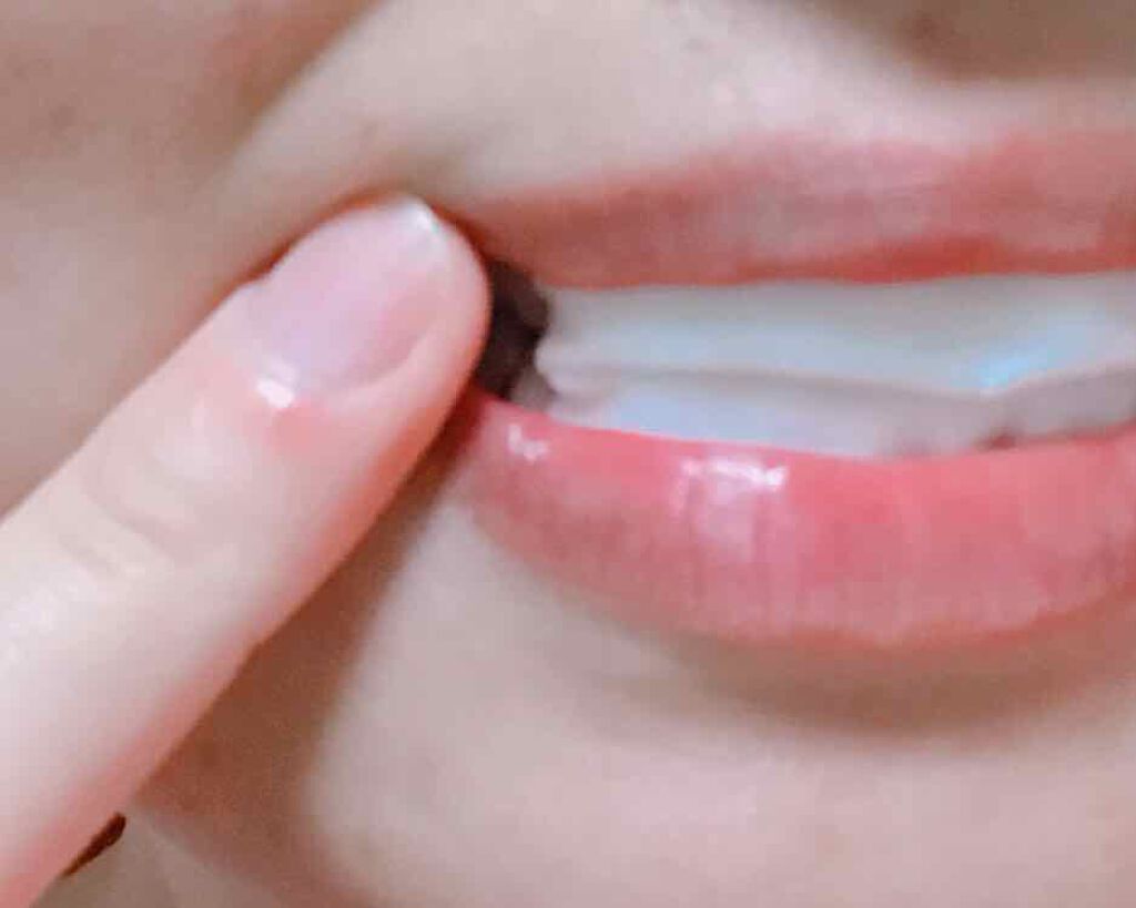 プレミアム ティースホワイトパック/Smile Cosmetique/その他オーラルケアを使ったクチコミ（3枚目）