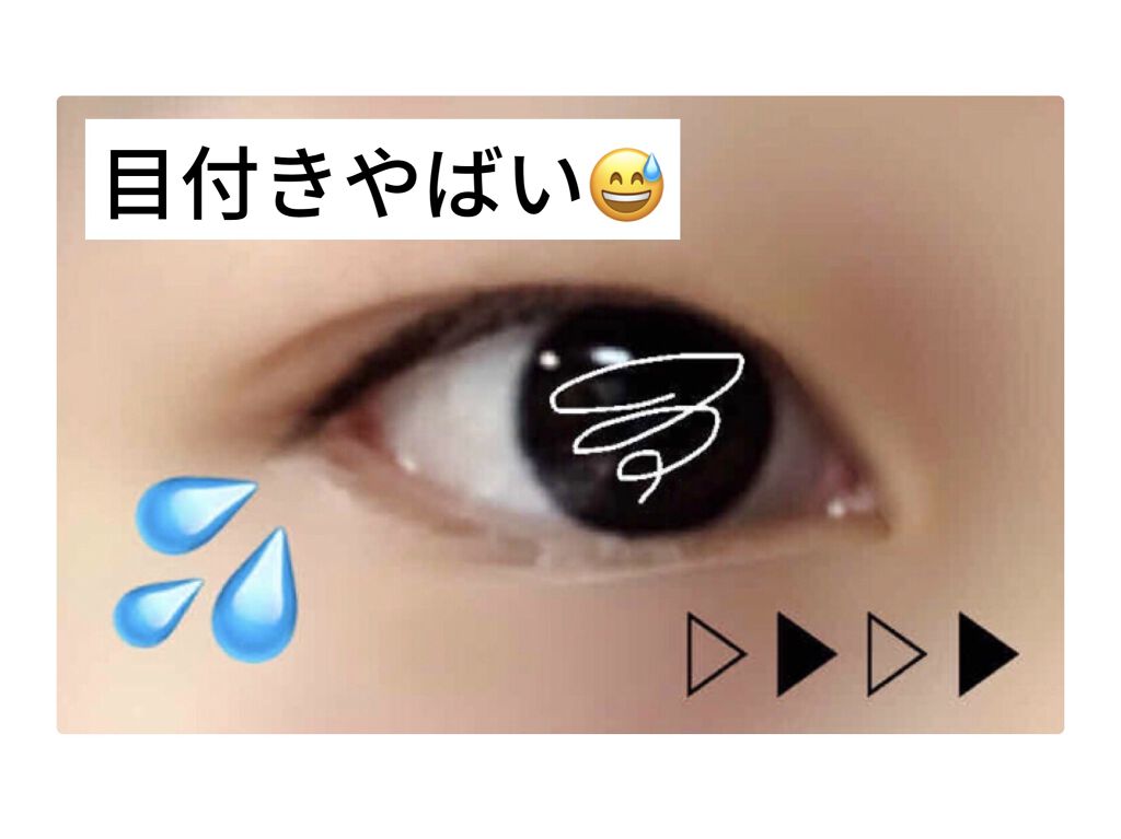 肌色タイプ/バンドエイド/その他を使ったクチコミ（2枚目）