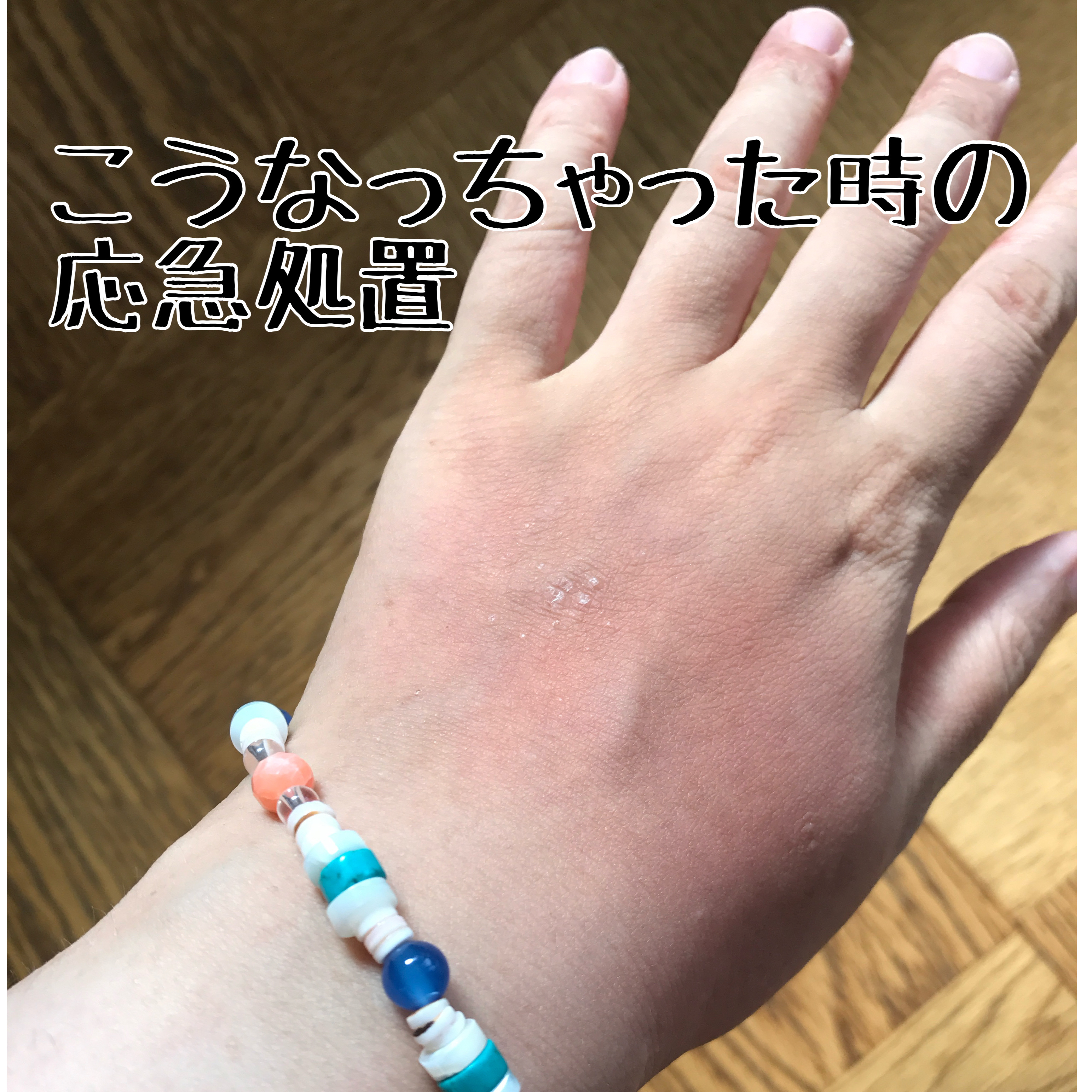 ミノン アミノモイスト モイストチャージ ローションII もっとしっとりタイプ/ミノン/化粧水を使ったクチコミ（1枚目）