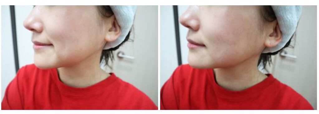 キムキム on LIPS 「アンニョンハセヨ~!最近肌質も変わってきて、スキンケアアイテム..」(2枚目)