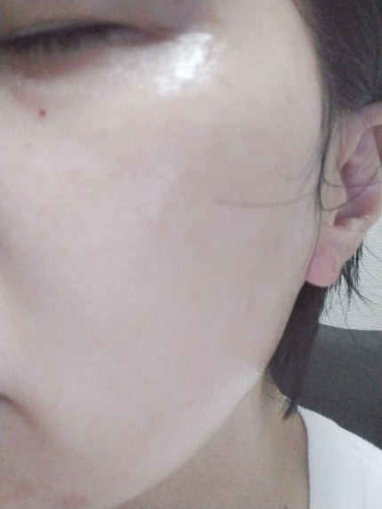 SUIKO HC ビタミン5エッセンスマスク/SUIKO HATSUCURE/シートマスク・パックを使ったクチコミ(4枚目)