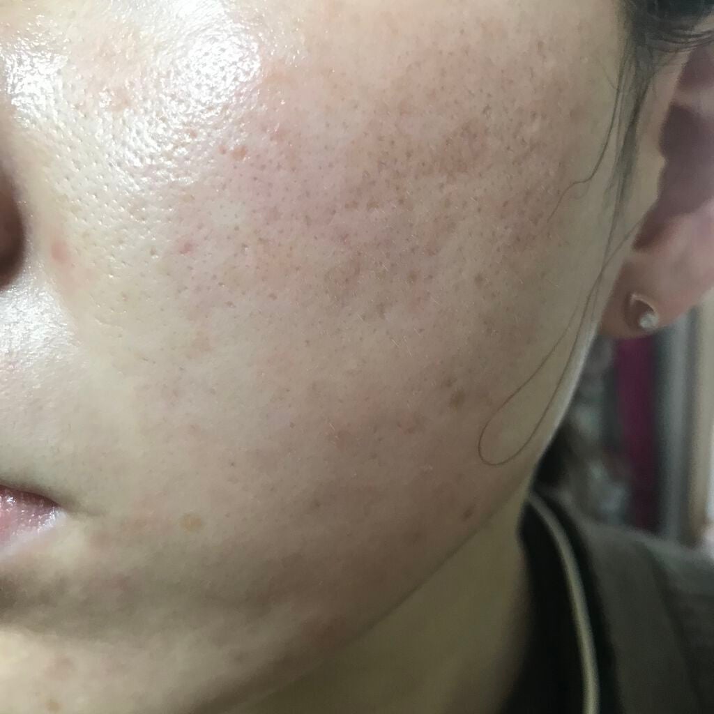 UVイデア XL プロテクショントーンアップ ローズ/ラ ロッシュ ポゼ/日焼け止めクリームを使ったクチコミ(2枚目)