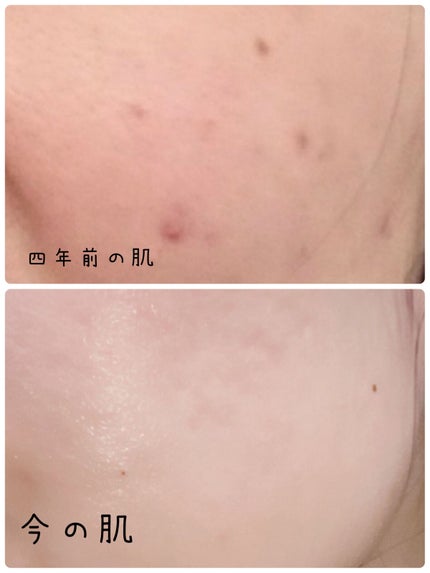 ブライトニングケア ローション RM(医薬部外品)/アクアレーベル/化粧水を使ったクチコミ(1枚目)