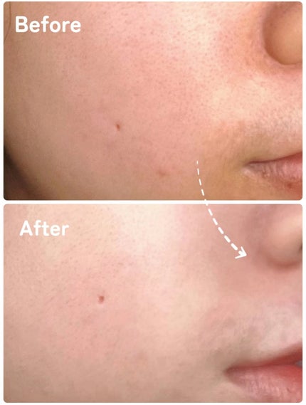 マスクフィット クリスタルメッシュクッション/TIRTIR(ティルティル)/クッションファンデーションを使ったクチコミ(3枚目)