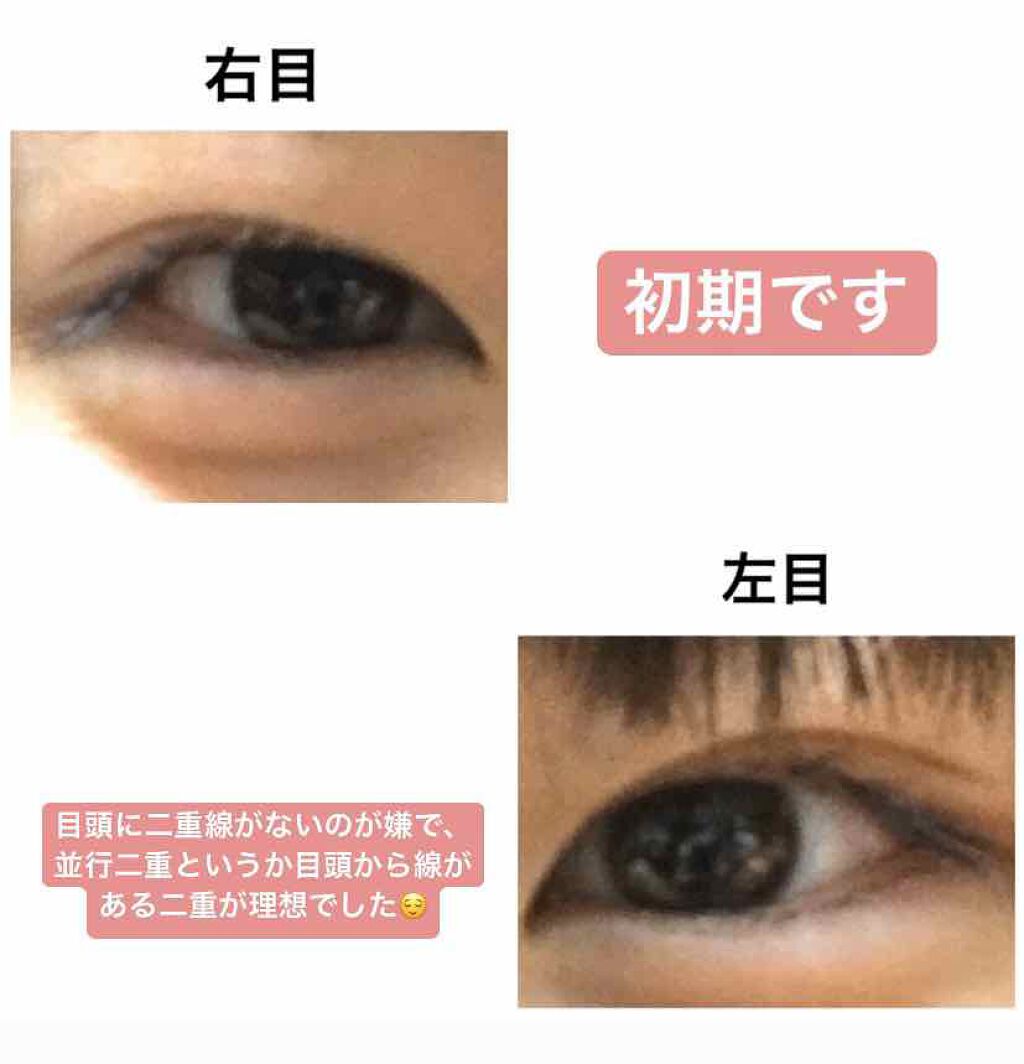 ナイトアイボーテ/StreeTrend/二重まぶた用アイテムを使ったクチコミ（2枚目）