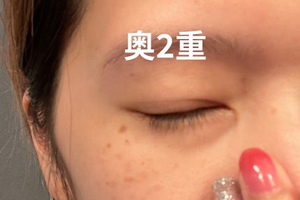 アイビューティー フィクサー WP/アストレア ヴィルゴ/二重まぶた用アイテムを使ったクチコミ(2枚目)