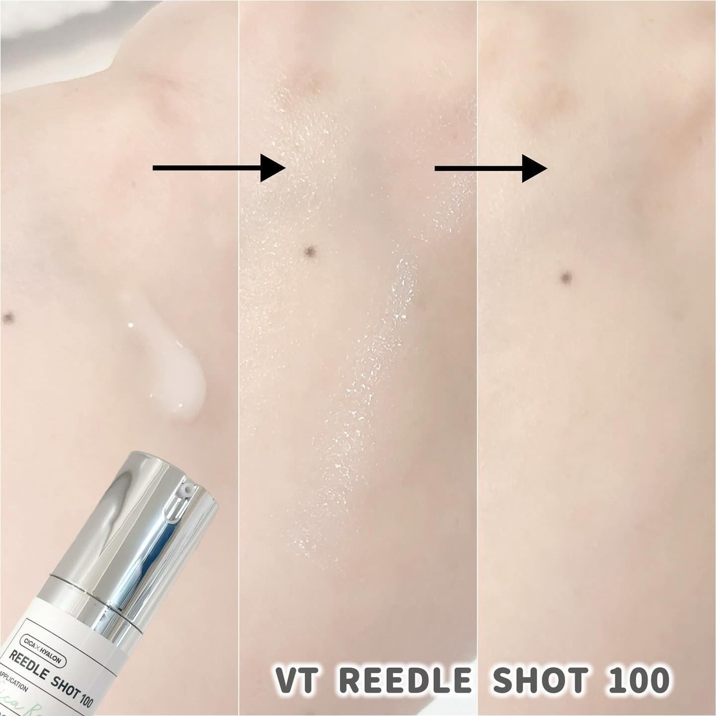 リードルショット100/VT/美容液を使ったクチコミ(4枚目)