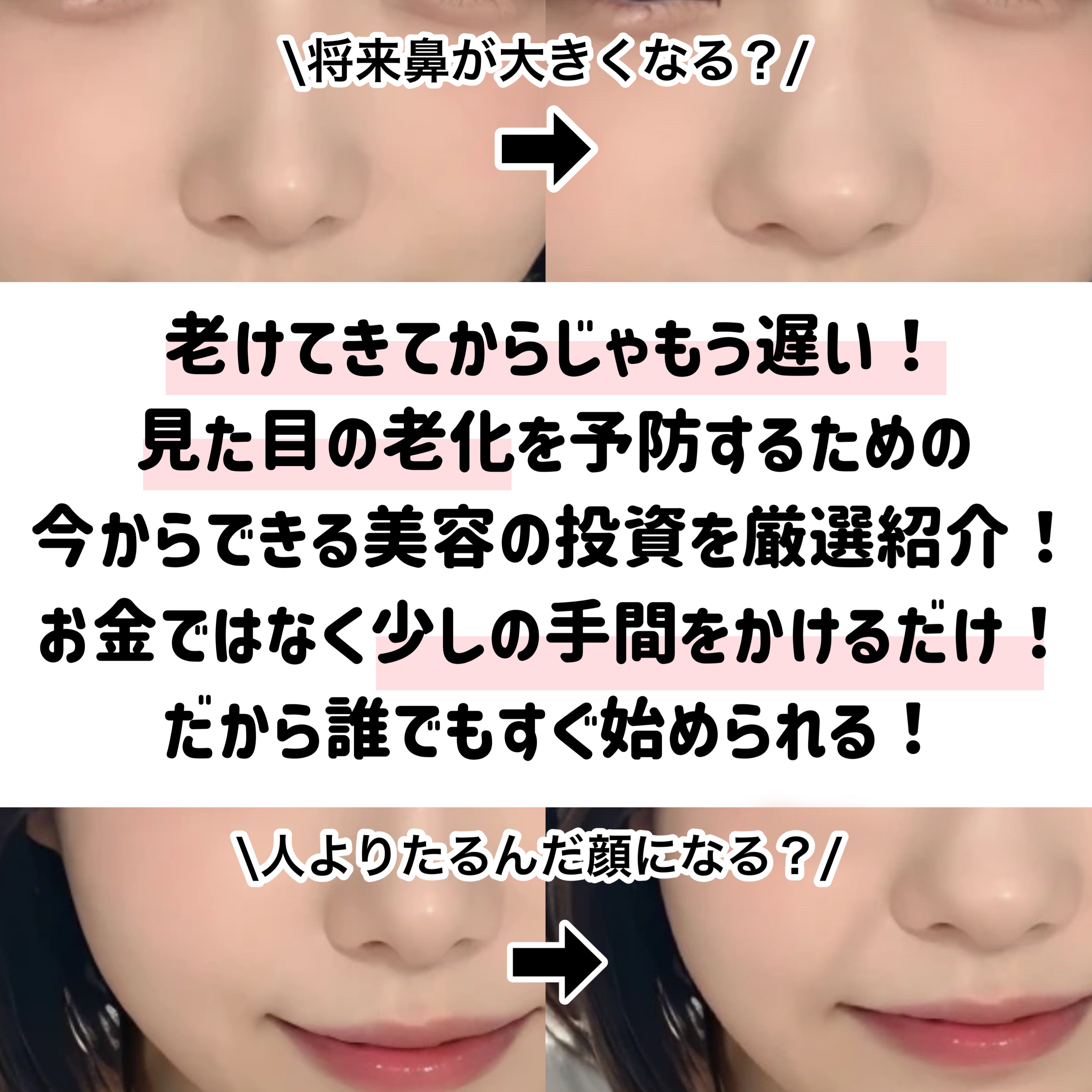 ハトムギ化粧水(ナチュリエ スキンコンディショナー R )/ナチュリエ/化粧水を使ったクチコミ（2枚目）