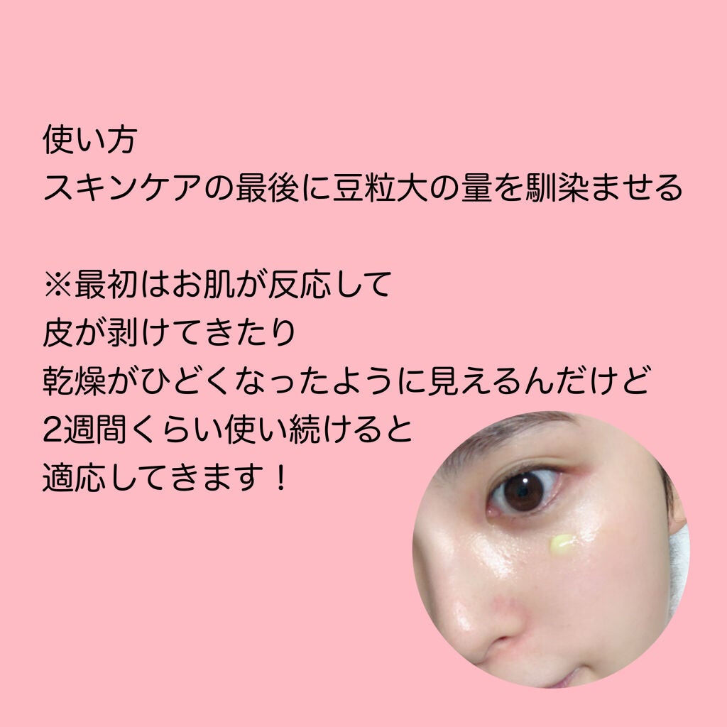 Vita-A クリーム フォルテ/Dr.Different/フェイスクリームを使ったクチコミ(7枚目)