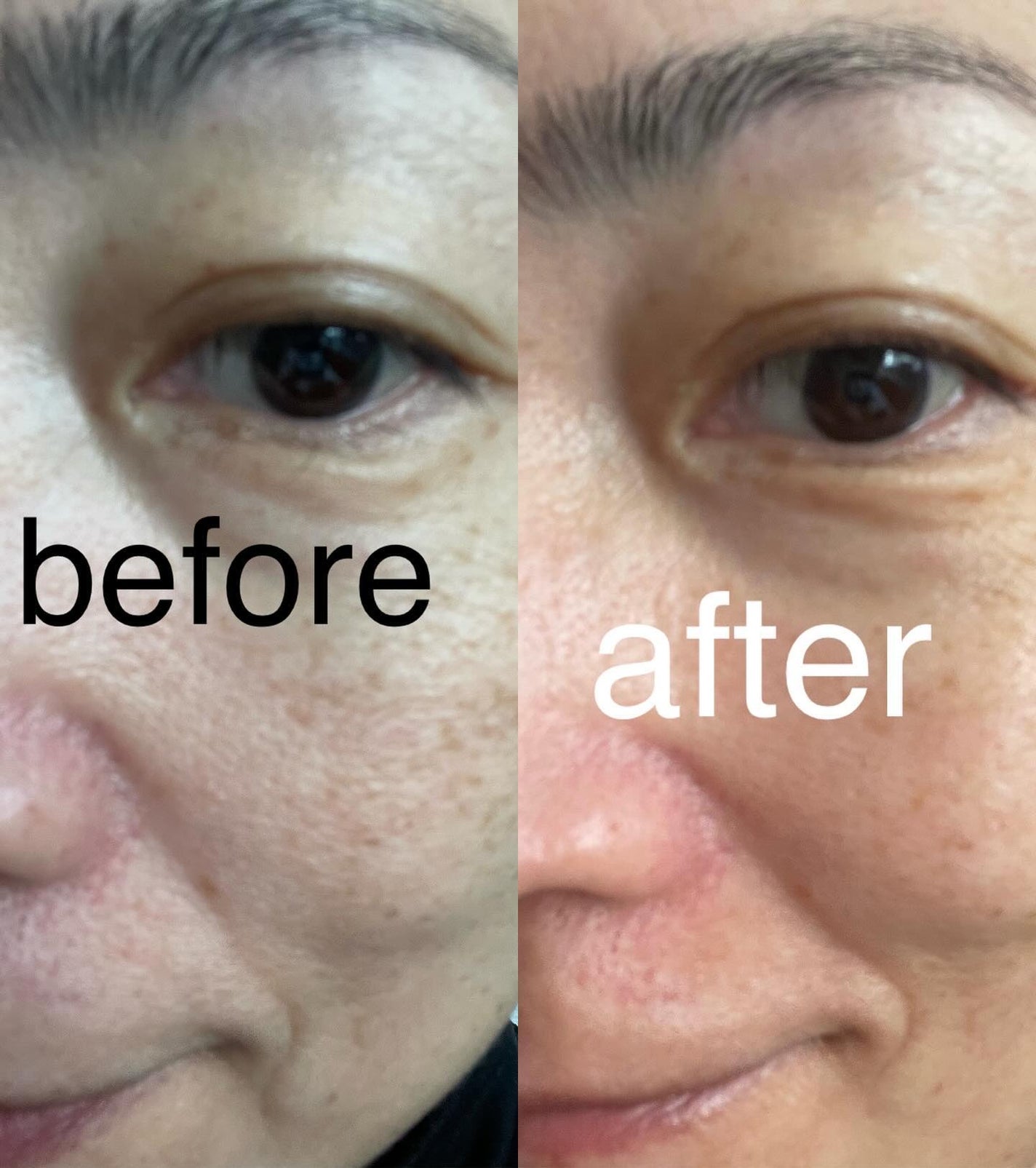 エイシカ365マイクロセラム/AESTURA/美容液を使ったクチコミ(5枚目)