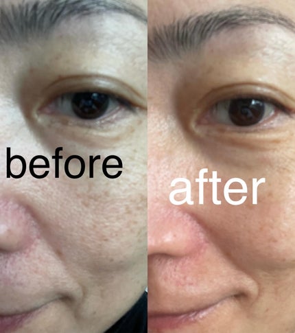 エイシカ365マイクロセラム/AESTURA/美容液を使ったクチコミ(5枚目)