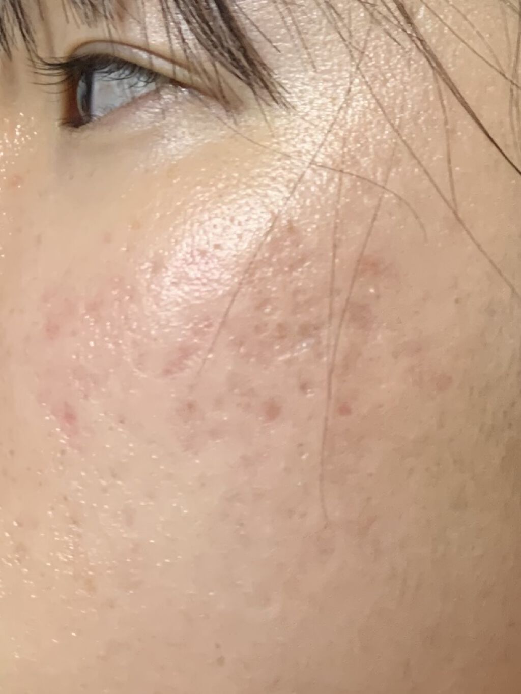 オードムーゲ 薬用ローション（ふきとり化粧水）/オードムーゲ/拭き取り化粧水を使ったクチコミ（2枚目）