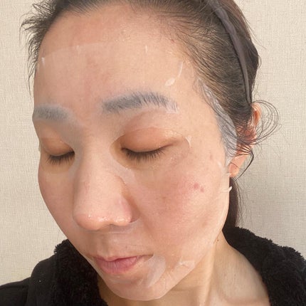 スーパーシカクイックマスクパック/MEDICUBE/シートマスク・パックを使ったクチコミ(6枚目)