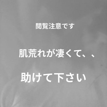 スキンケア洗顔料 薬用アクネケア/ビオレ/洗顔フォームを使ったクチコミ（1枚目）