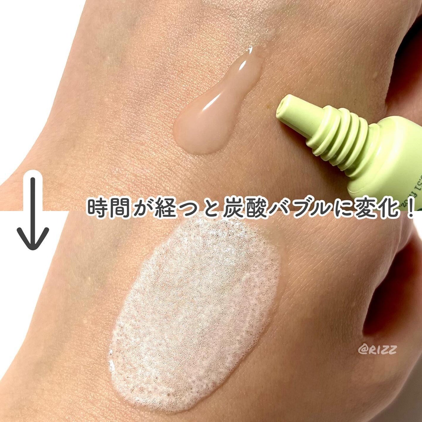 スパークリングスカルプスケーラー/ミンツリー/頭皮ケアを使ったクチコミ(2枚目)