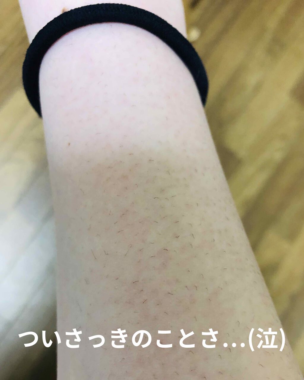 ミュゼコスメ メンズ 薬用ヘアリムーバルクリーム ホワイトシトラスの香り/ミュゼコスメ/除毛クリームを使ったクチコミ(2枚目)