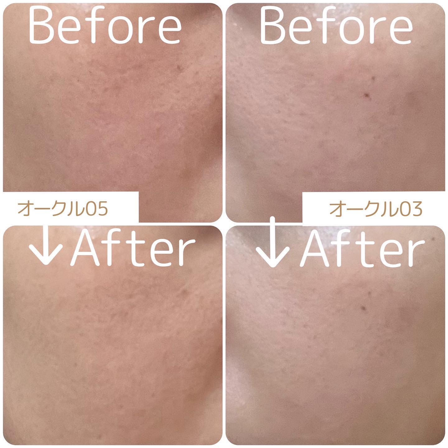 プリマヴィスタ デイトリートメントバーム 〈ローラータイプ〉/プリマヴィスタ/その他ファンデーションを使ったクチコミ（3枚目）