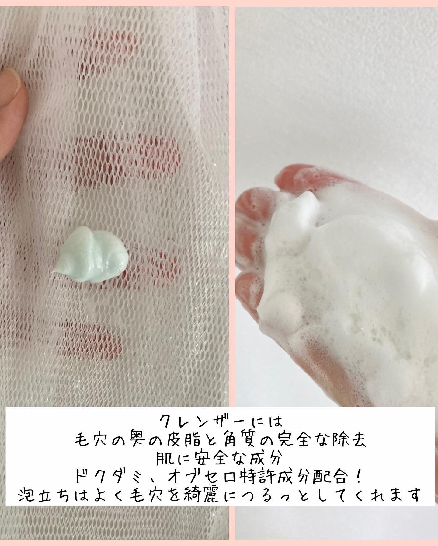 エーキュアショットスポットパッチ/obsero/にきびパッチを使ったクチコミ（3枚目）