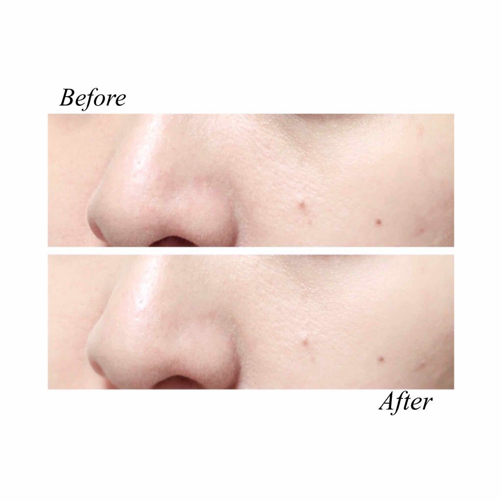 オーガニックスティックコンシーラー/アクア・アクア/スティックコンシーラーを使ったクチコミ(4枚目)