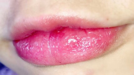 マシュマロティントルージュ/フォーチュン/リップティントを使ったクチコミ(7枚目)