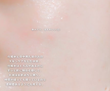 ドレススノー ローション【医薬部外品】 /アテニア/化粧水を使ったクチコミ(4枚目)