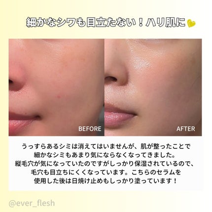 グルタチオングロウアンプル/MEDICUBE/美容液を使ったクチコミ(5枚目)