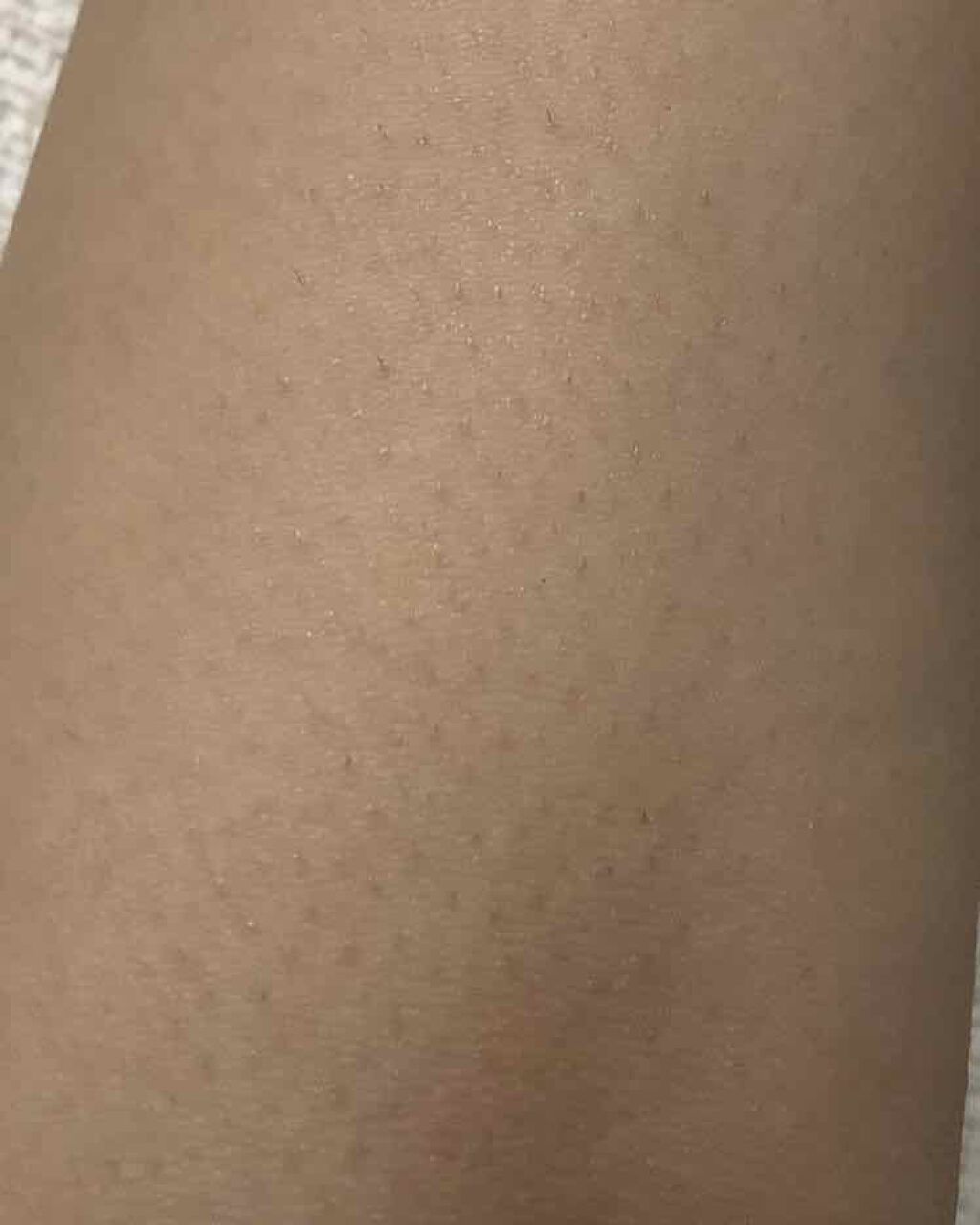 FASIZ607C IPL光脱毛器/FASIZ/家庭用脱毛器を使ったクチコミ（3枚目）