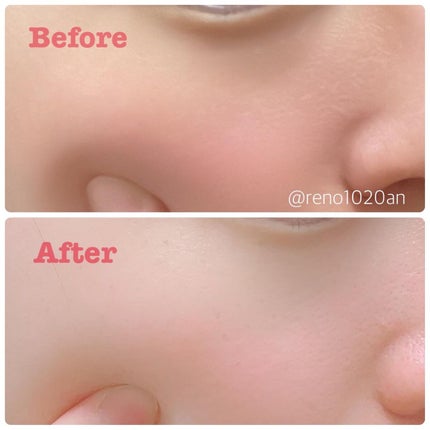 ダーマエアショット/MEDICUBE/美顔器・マッサージを使ったクチコミ(5枚目)