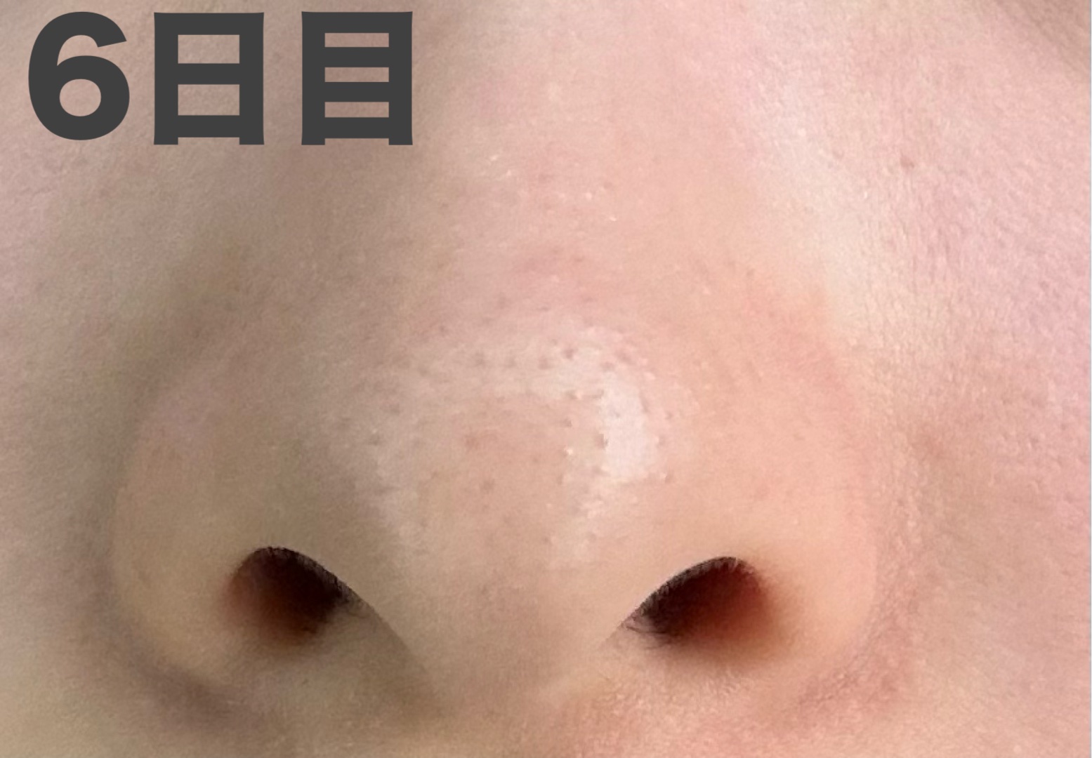 デュオ ザ ウォッシュ ブラックリペア/DUO/洗顔パウダーを使ったクチコミ（2枚目）