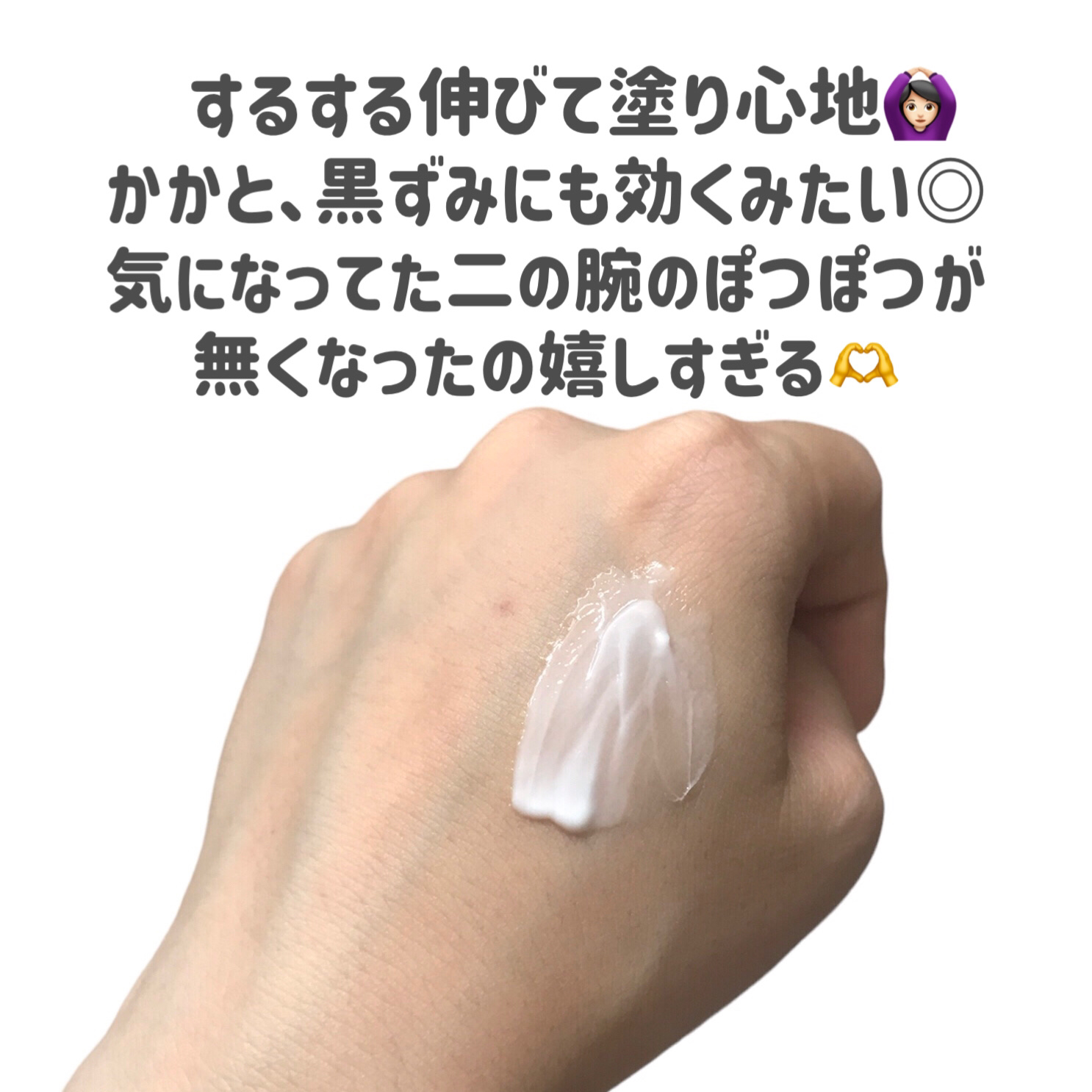 コーワ20％尿素配合クリーム(医薬品)/ケラチナミン/その他を使ったクチコミ（2枚目）