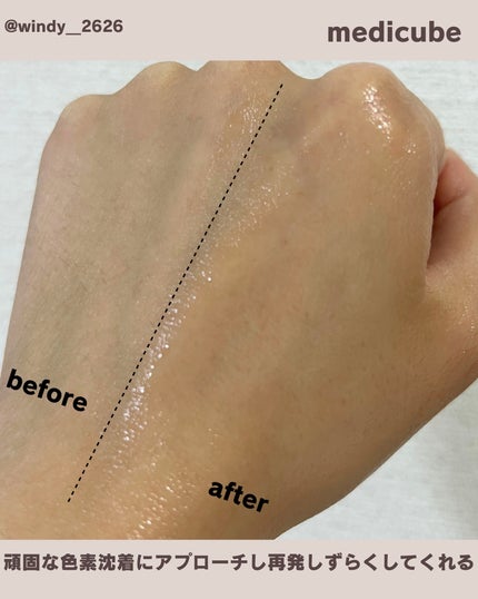 PDRNピンクアンプル PDRN 10,000ppm配合/MEDICUBE/美容液を使ったクチコミ(4枚目)