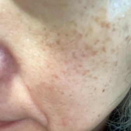 ritan on LIPS 「▶report7ナチュラルダーマプロジェクト様からザクロビタミ..」(7枚目)