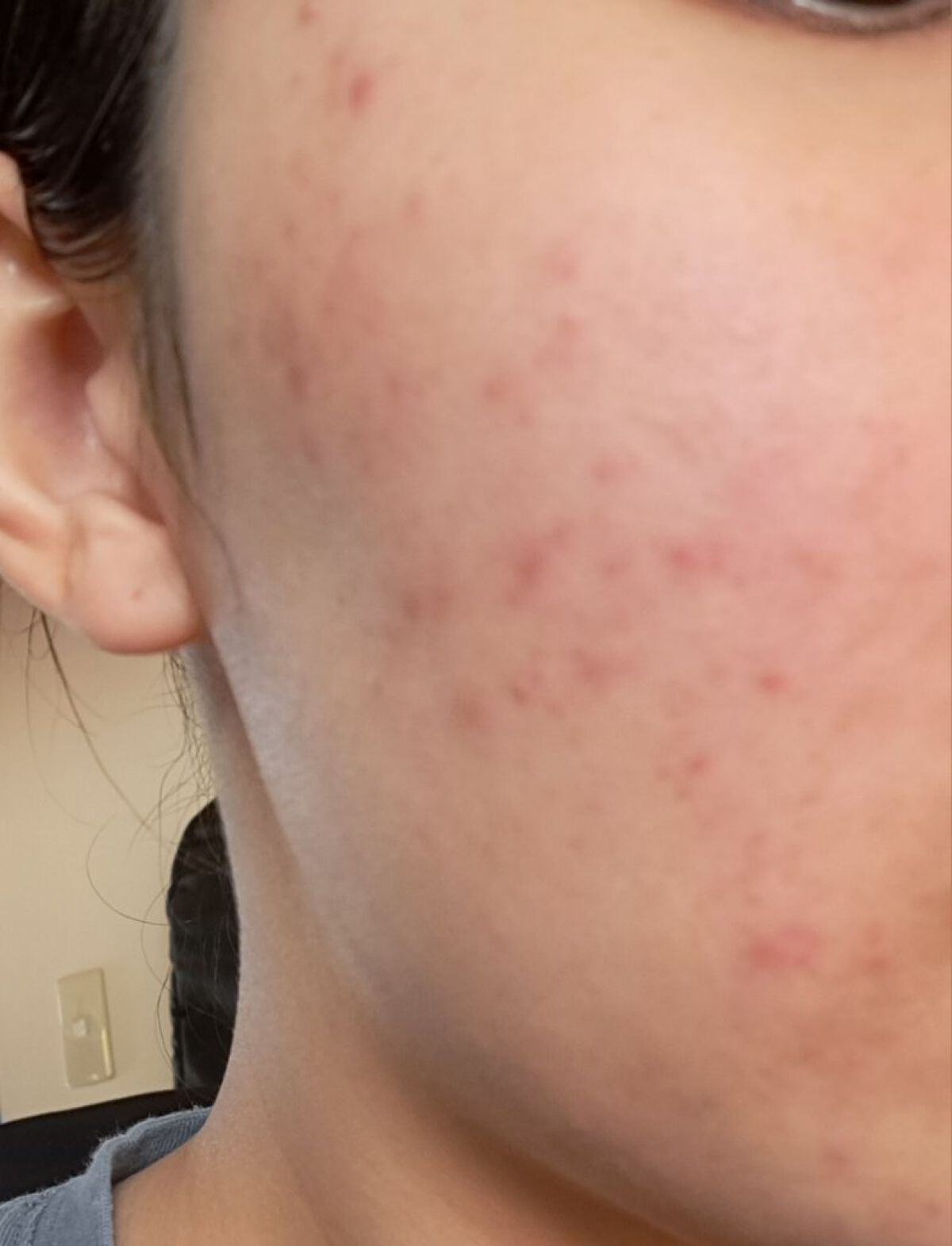 保湿UVクリーム/アトピタ/日焼け止めクリームを使ったクチコミ（1枚目）