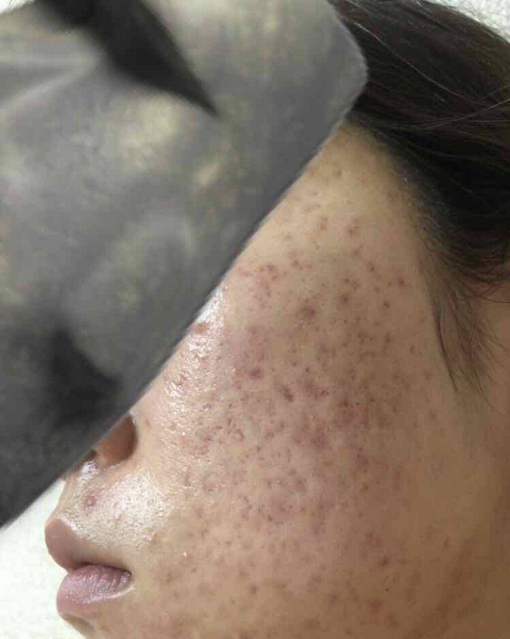 サンシビオ エイチツーオー D/ビオデルマ/クレンジングウォーターを使ったクチコミ（2枚目）