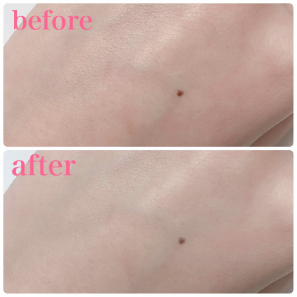 ホワイト パウダレスト/ALBION/パウダーファンデーションを使ったクチコミ（3枚目）