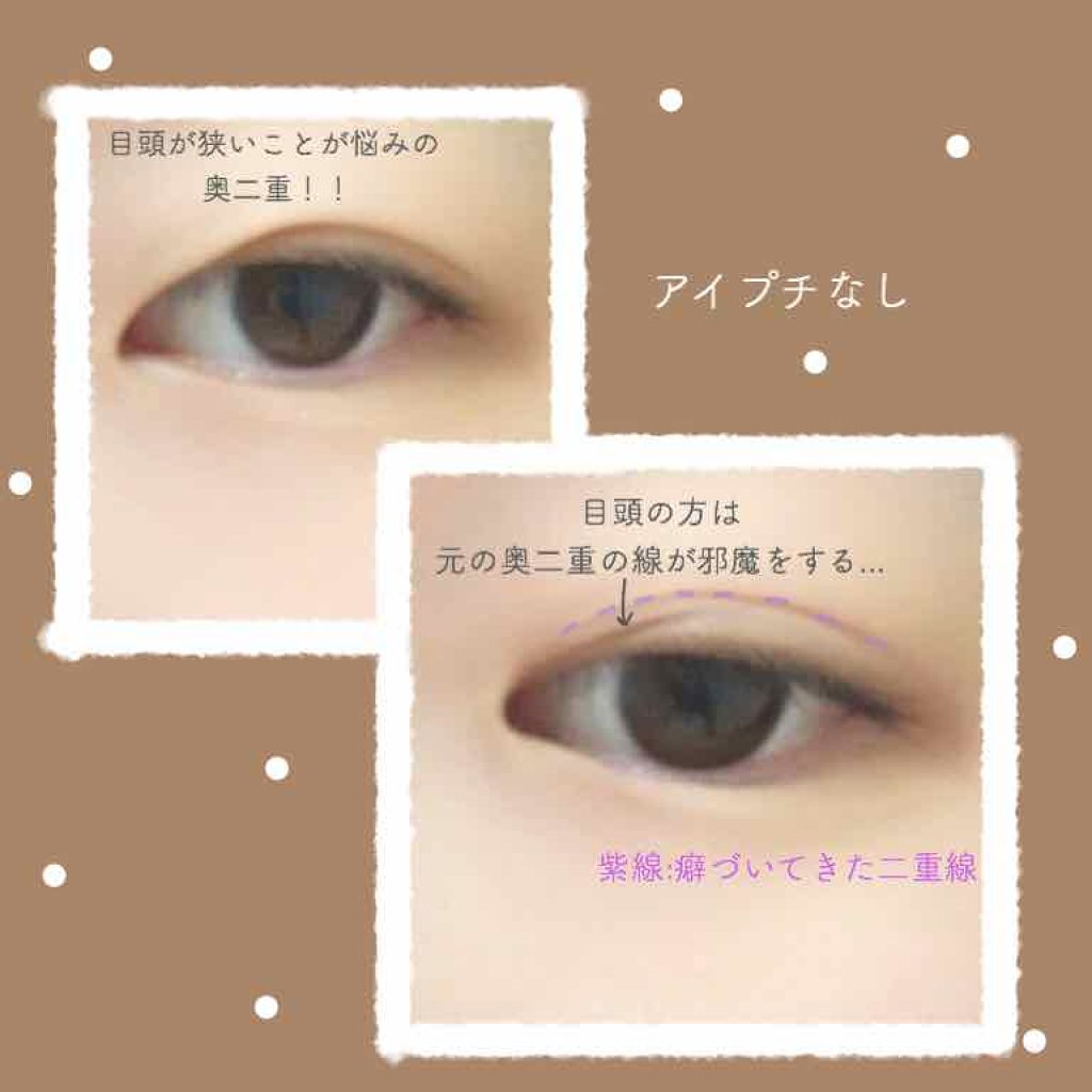 リキッドフィルム/ラクオリ/二重まぶた用アイテムを使ったクチコミ（2枚目）