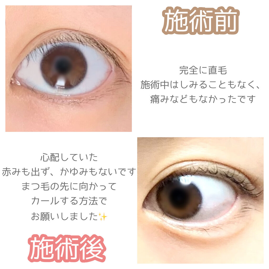 ラッシュアディクト アイラッシュコンディショニングセラム/soaddicted/まつげ美容液を使ったクチコミ（2枚目）