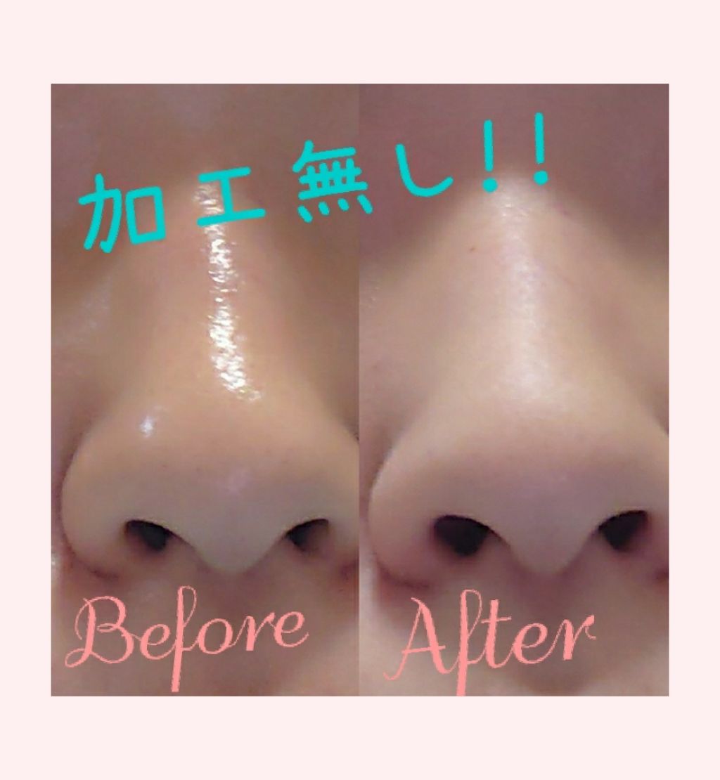 デュオ ザ クレンジングバーム/DUO/クレンジングバームを使ったクチコミ(1枚目)