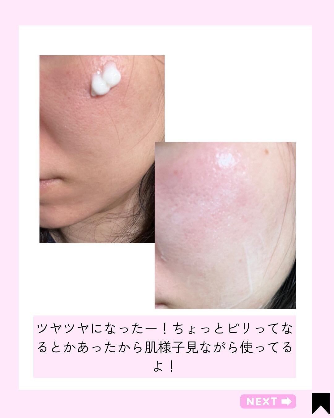 マジックカタツムリクリーム/ブラン/フェイスクリームを使ったクチコミ(5枚目)