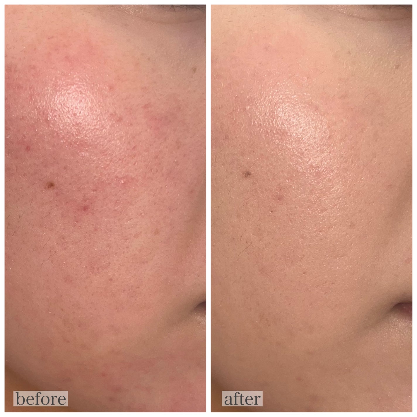 ピンクティーツリーカバークッション/APLIN/クッションファンデーションを使ったクチコミ(4枚目)