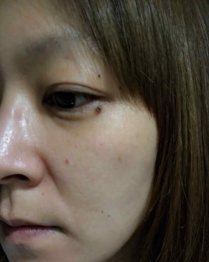 クレンザー&角質パット/WONDER BATH/洗い流すパック・マスクを使ったクチコミ(4枚目)