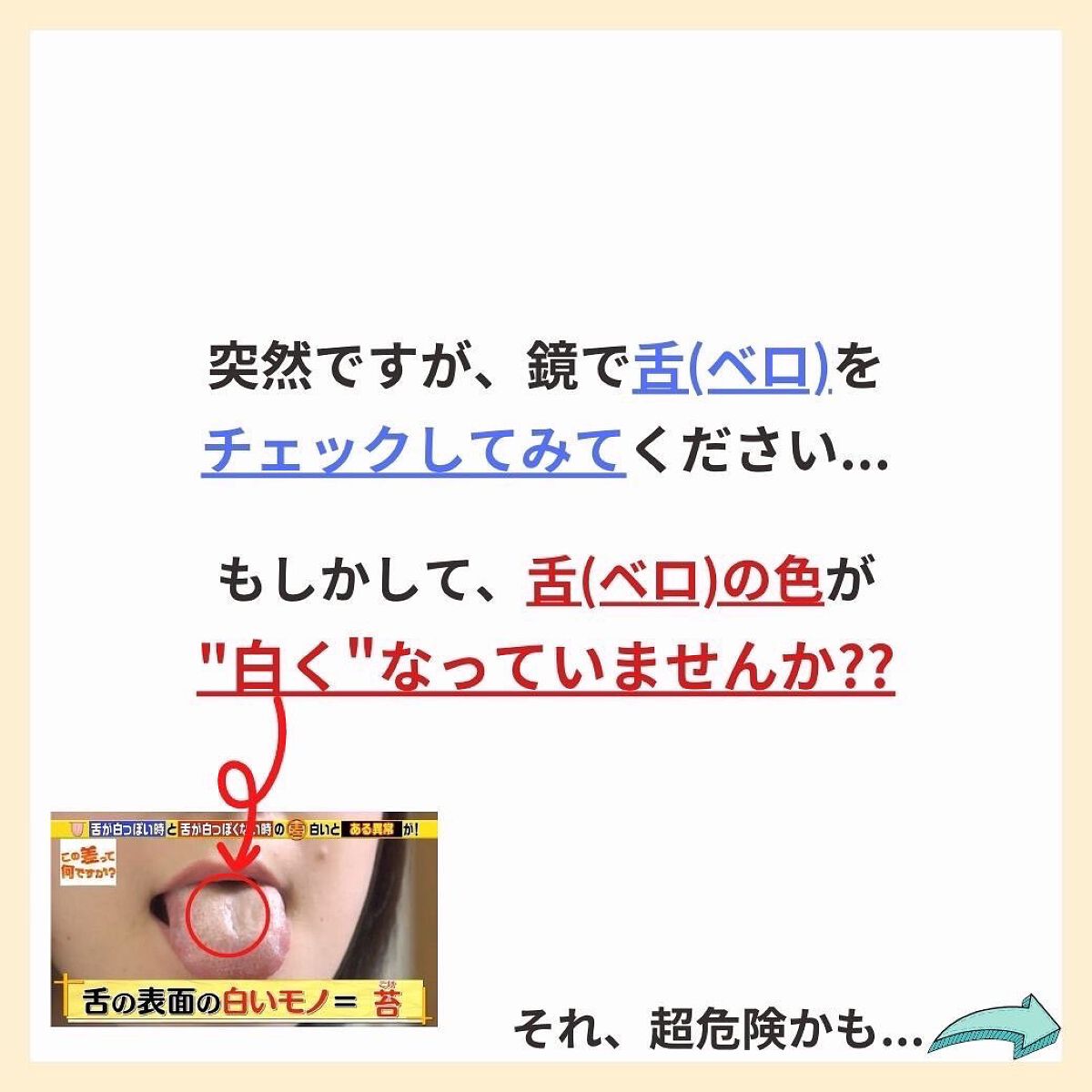 あなたの肌に合ったスキンケア💐コーくん先生 on LIPS 「【知らないと危険】舌がこんな色の人は危険🤫 ..あなたの毛穴..」(2枚目)