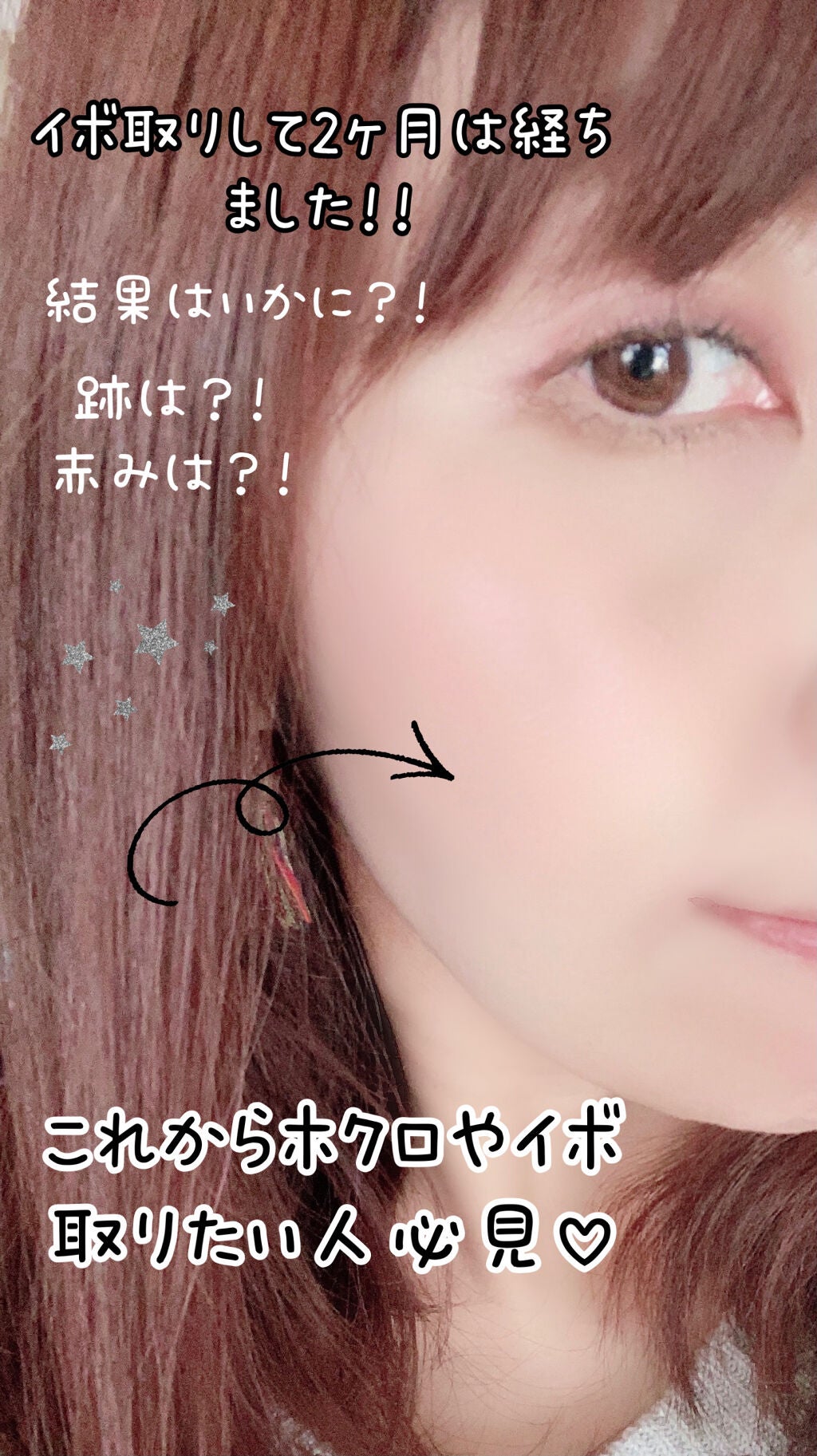 ディエム クルール カラーブレンドパウダーコンシーラー/ディエム クルール/パウダーコンシーラーを使ったクチコミ(1枚目)