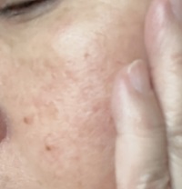 ソフニングローション/イオナR (イオナアール)/化粧水を使ったクチコミ（3枚目）