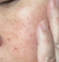 ソフニングローション/イオナR (イオナアール)/化粧水を使ったクチコミ(3枚目)