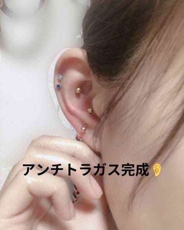 
⚠️ピアッシングレポです。苦手な人はご注意を



👂アンチトラガス開けてみた👂

自分の記録用&これから開けたいと思う誰か様の参考になれば幸いです💕

⭐️用意する物
　→14Gのニードル 
　→抗